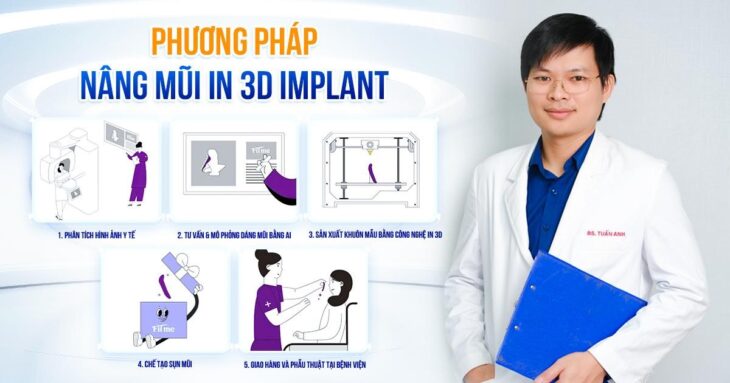 Giải pháp tạo dáng mũi chuẩn cá nhân hóa